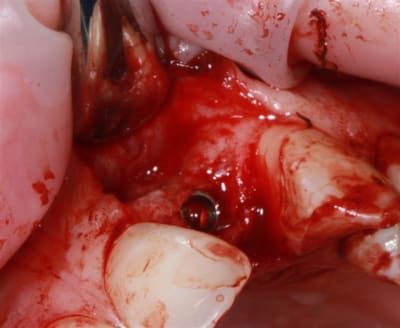 Img 2256 xufzdm - Eugenol