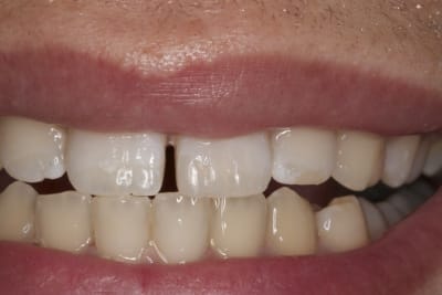 Img 2302 gnweru - Eugenol