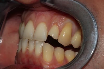 Img 2380 p1vyu5 - Eugenol