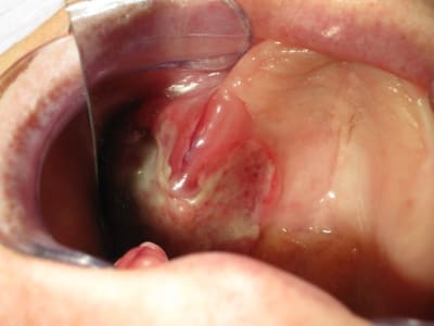 Img 2383 ldedbr - Eugenol