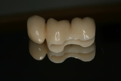 Img 2391 vbfac7 - Eugenol