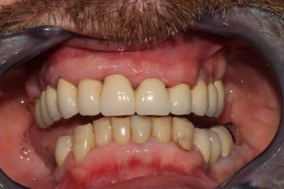 Img 2618 mrucoa - Eugenol