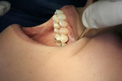 Img 2745 spi4yt - Eugenol