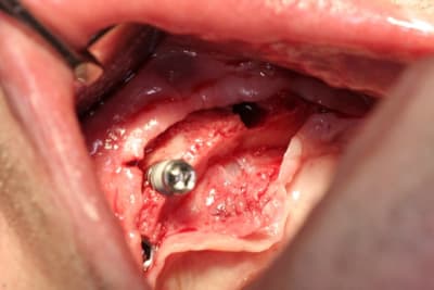 Img 2784 c3pdr2 - Eugenol