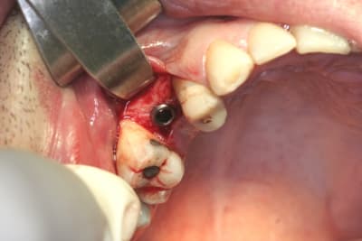 Img 2807 w9cros - Eugenol