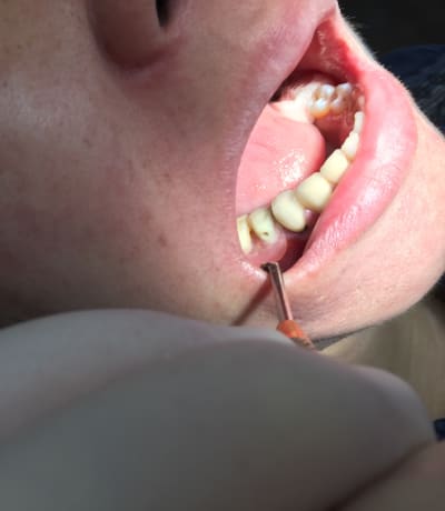 Img 2895 fdiurf - Eugenol