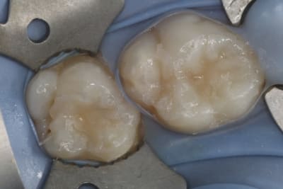 Img 2986 wcqzdi - Eugenol