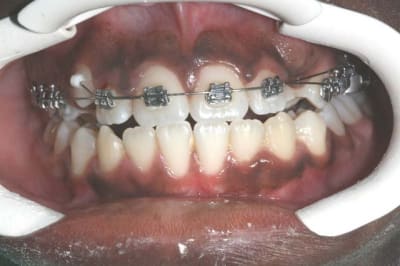 Img 2 f1urwp - Eugenol