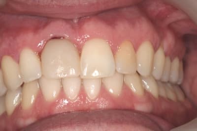 Img 3033 sldzij - Eugenol