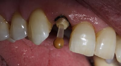 Img 3098 k9vpfc - Eugenol