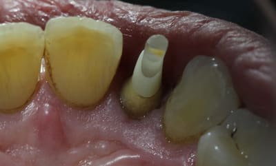 Img 3164 bh0kae - Eugenol