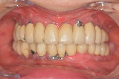 Img 3201 do6gy0 - Eugenol