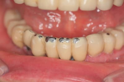 Img 3202 zxdofi - Eugenol