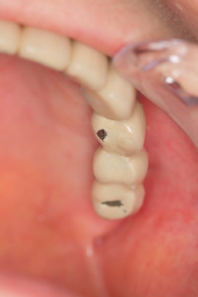 Img 3204 zauidb - Eugenol