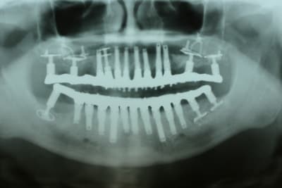 Img 3227 zft6be - Eugenol