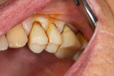 Img 3349 diqryh - Eugenol