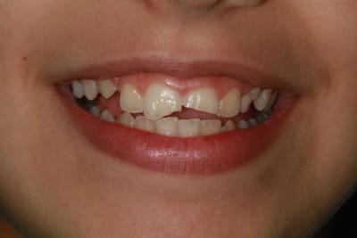 Img 3375 pb4hcb - Eugenol