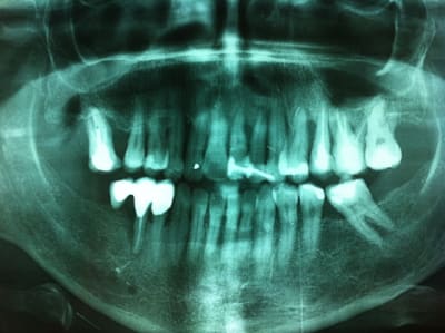 Img 3520 tbvfol - Eugenol