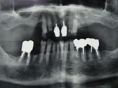 Img 3608 krmvyv - Eugenol