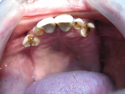 Img 3611 z2ib4j - Eugenol