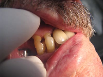 Img 3615 ybas99 - Eugenol