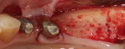 Img 3619 stgsrp - Eugenol