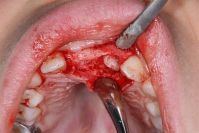 Img 3 by7ex5 - Eugenol