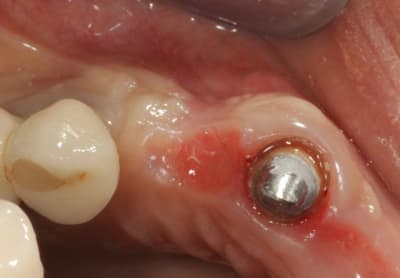 Img 4236 gmaxew - Eugenol