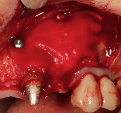 Img 4241 fdfg5b - Eugenol