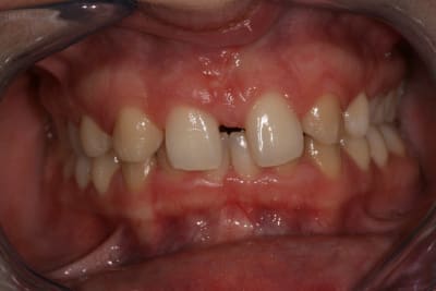 Img 4258 iktkgx - Eugenol