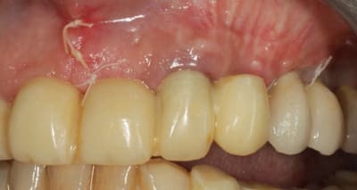 Img 4423 ldtlsu - Eugenol