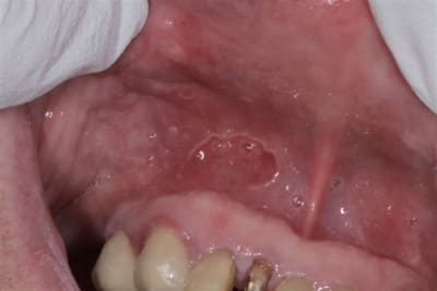 Img 4615 uklpen - Eugenol