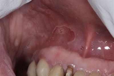 Img 4617 pjf1tn - Eugenol