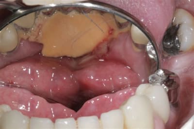 Img 4618 th7zkt - Eugenol