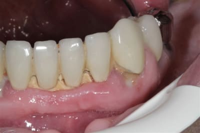 Img 4620 dkvaek - Eugenol