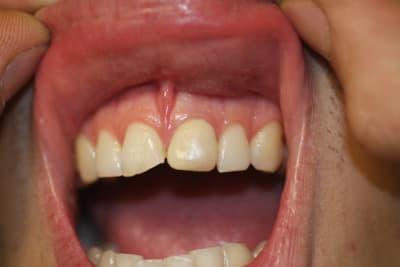 Img 4821 l2a9x6 - Eugenol