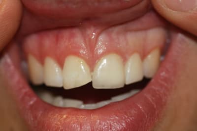 Img 4824 g4eixz - Eugenol