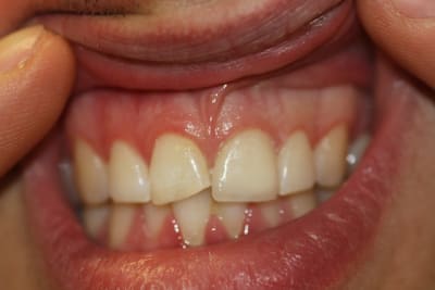 Img 4825 cknred - Eugenol