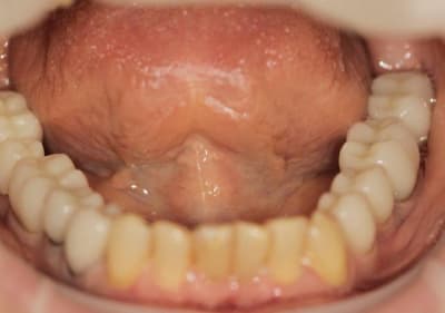 Img 4840 url34k - Eugenol