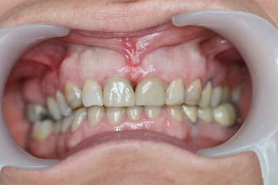 Img 4844 r2mjht - Eugenol