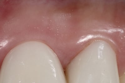 Img 4883 vynukl - Eugenol