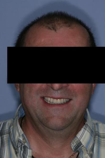 Img 49201 q8ztyo - Eugenol