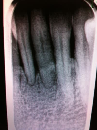 Img 5011 bppdtm - Eugenol