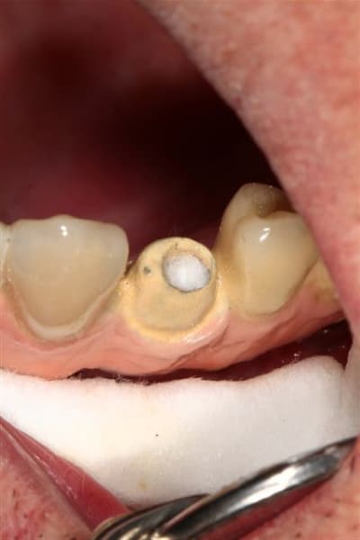 Img 5017 fnnpkt - Eugenol