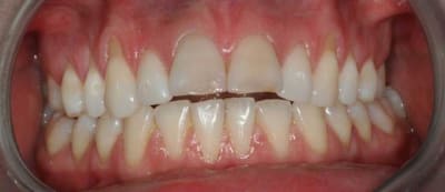 Img 5032 eimylb - Eugenol