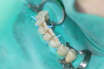 Img 5113 jvnva3 - Eugenol