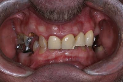 Img 5229 ypplf9 - Eugenol