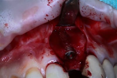 Img 5294 enzuzp - Eugenol