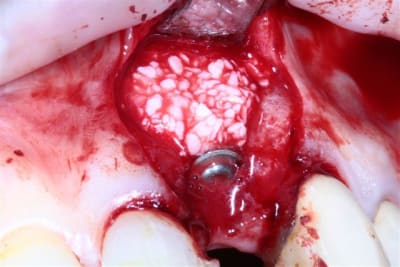 Img 5296 g64m3q - Eugenol