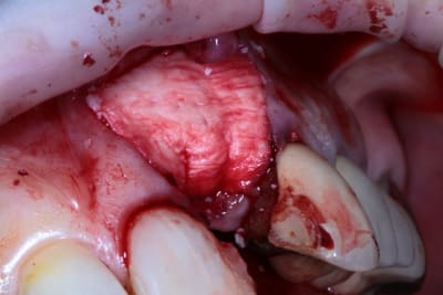 Img 5298 hfhu98 - Eugenol